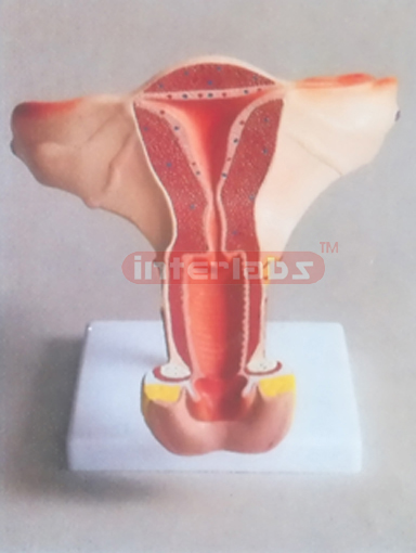 NATURAL FEMALE INTERNAL GENITAL ORGANS, SHOWING UTERUS, INTERNAL GENITAL ORGANS